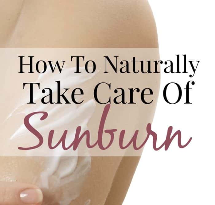 Image shows a shoulder with lotion on it with text that reads "How to Naturally Take Care of Sunburn"